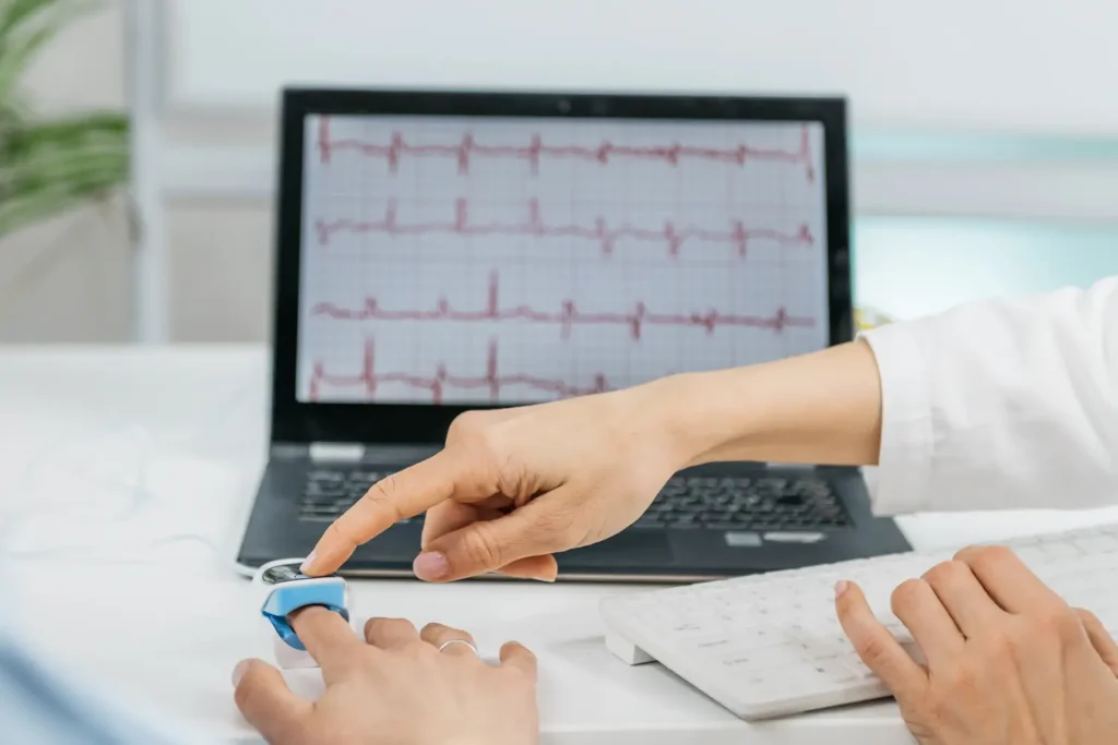 Imagen de electrocardiograma anormal – diagnóstico de la cardiopatía isquémica